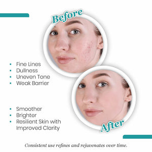 Encapsulated 0.3% Retinol Night Cream - Immaculate