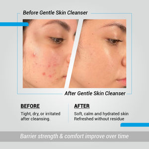 Gentle Face Cleanser - Immaculate