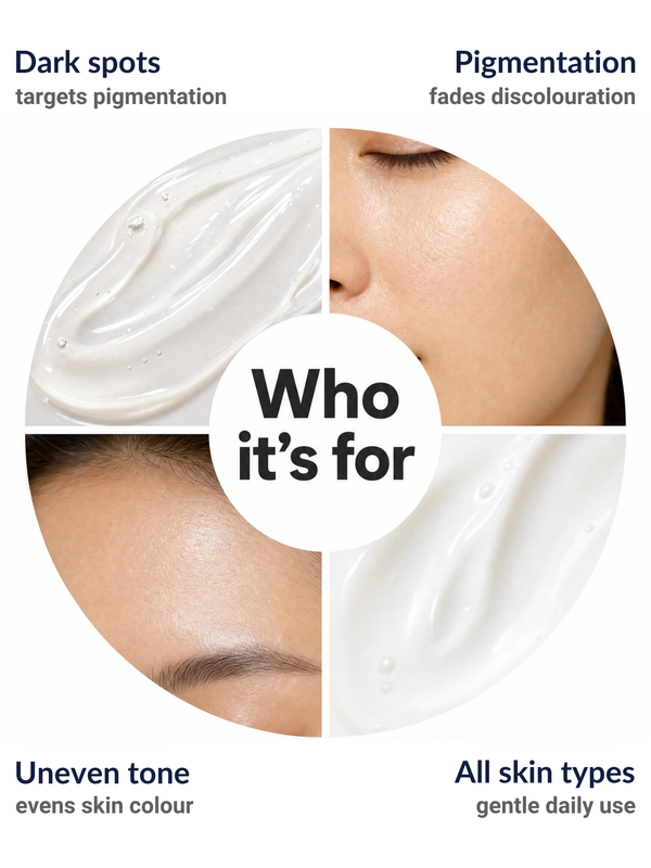 Who the Immaculate Alpha Arbutin 2% Face Serum suits: dark spots, pigmentation, uneven tone and all skin types