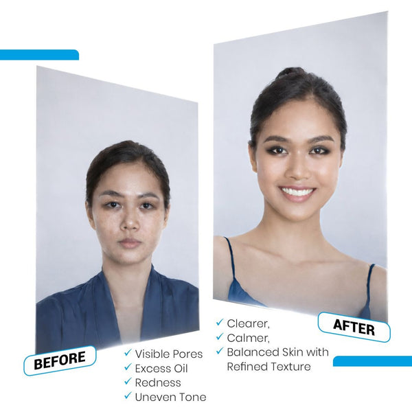 Niacinamide 10% + Zinc Face Serum - Immaculate