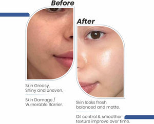 Daily Oil-Free Face Moisturiser - Immaculate