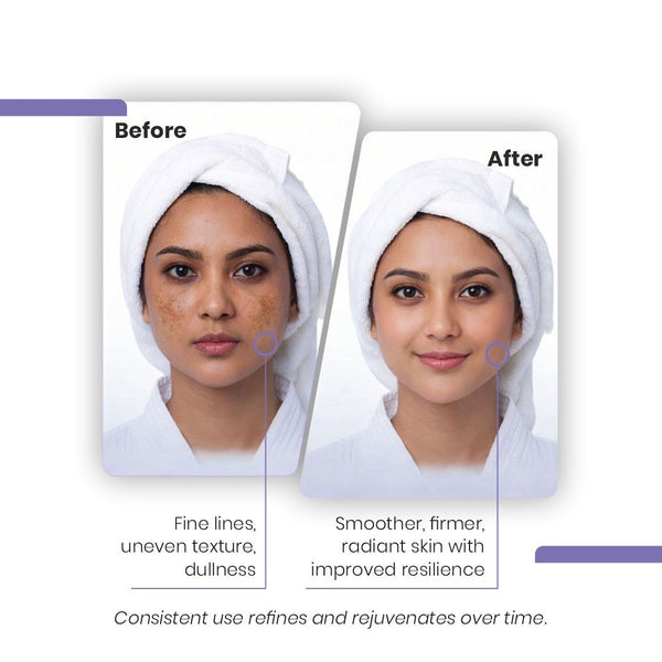 Retinol 0.3% Face Serum - Immaculate