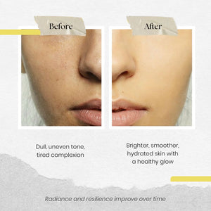 Vitamin C 10% Face Serum - Immaculate